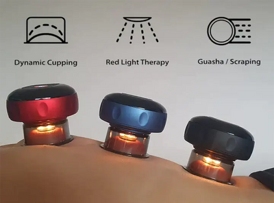 SmartCup dynamic cupping therapy with red light and guasha effects for muscle relief and recovery.